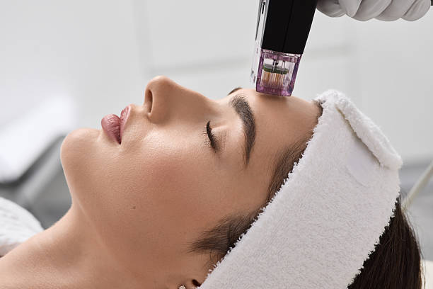 Morpheus8 Wien als moderne Alternative mit Individerm RF Matrix